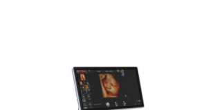 Что такое аппарат УЗИ и для чего он нужен? Что такое аппарат УЗИ и для чего он нужен?